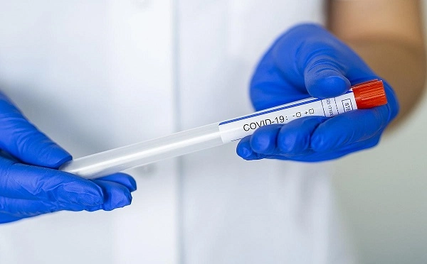 საქართველოში კორონავირუსის 479 ახალი შემთხვევა გამოვლინდა
