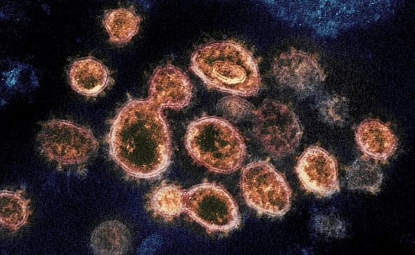 საქართველოში კორონავირუსის 2 514 ახალი შემთხვევა გამოვლინდა