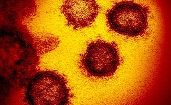 საქართველოში ბოლო 24 საათში კორონავირუსით 30 პაციენტი გარდაიცვალა 